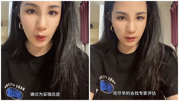 呆宝静公开儿子健康状况